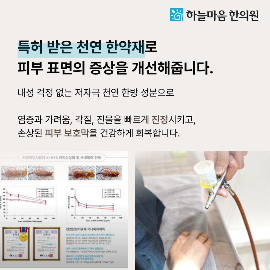 하늘마음한의원 청주점 천연 한약재 피부 치료
