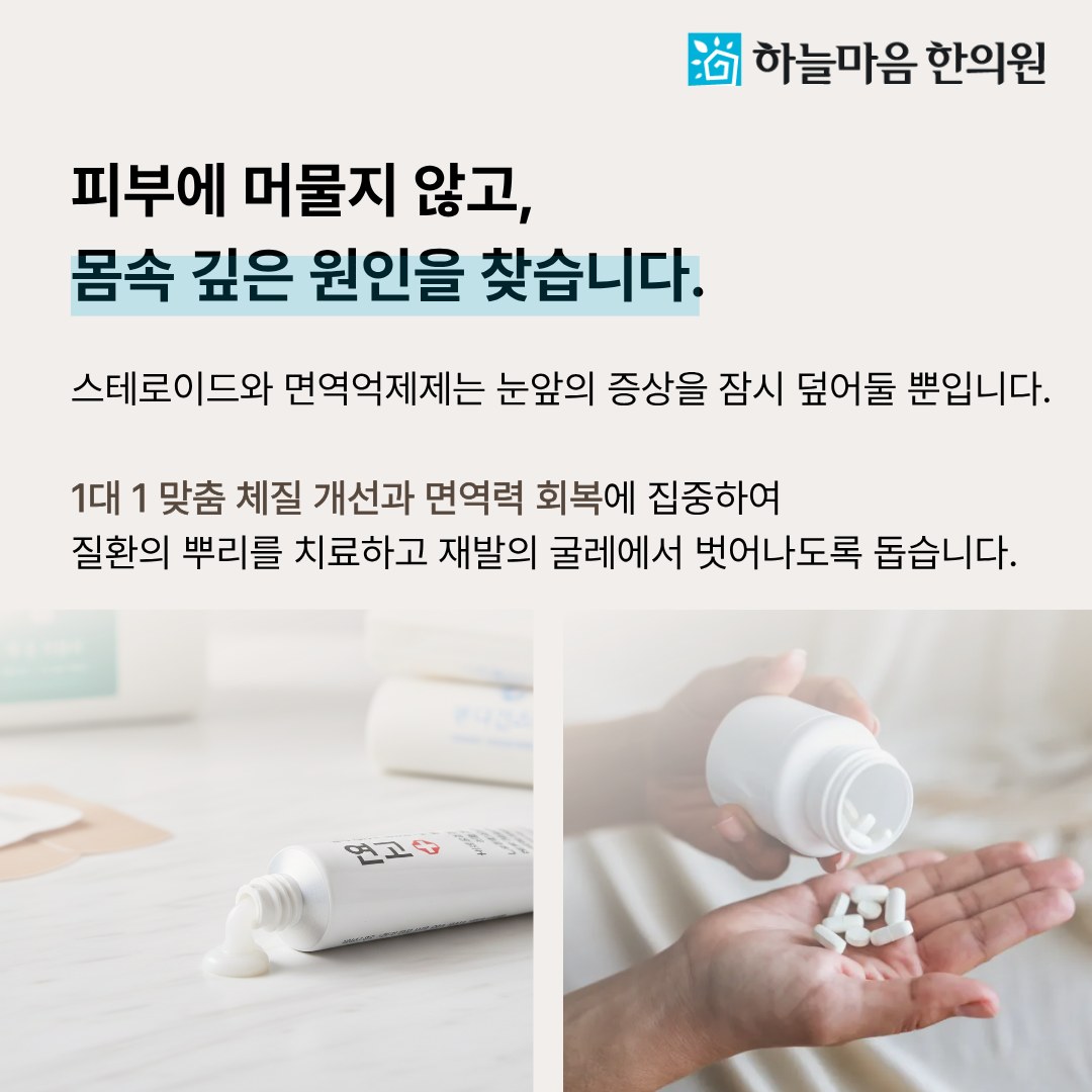 하늘마음한의원 청주점 피부질환의 몸속 원인 치료