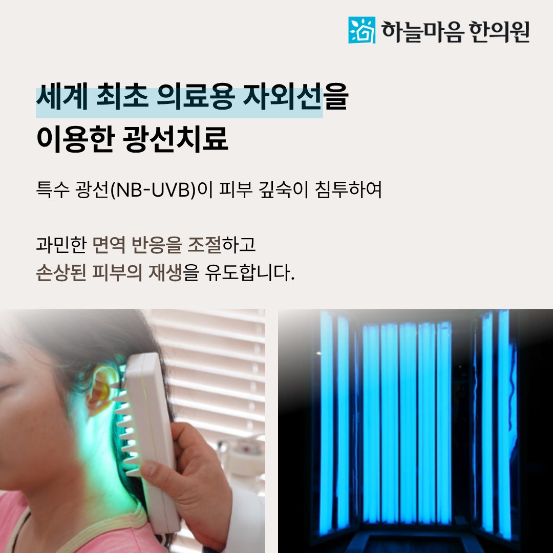 하늘마음한의원 청주점 NB-UVB 광선치료