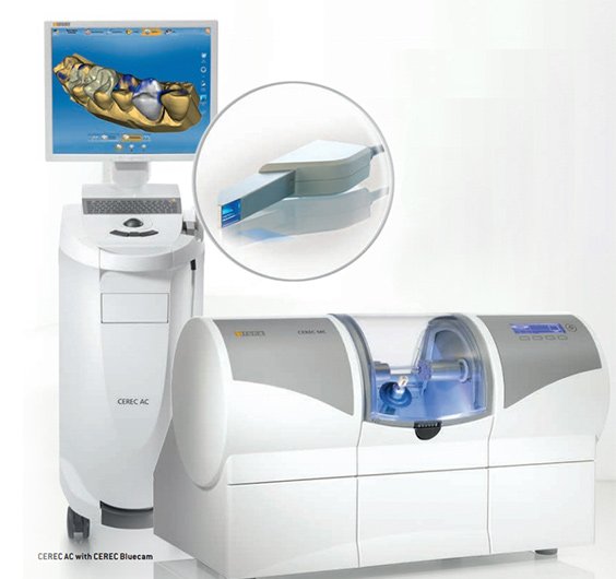 루체치과 디지털 보철을 만드는 세렉(CEREC) CAD/CAM